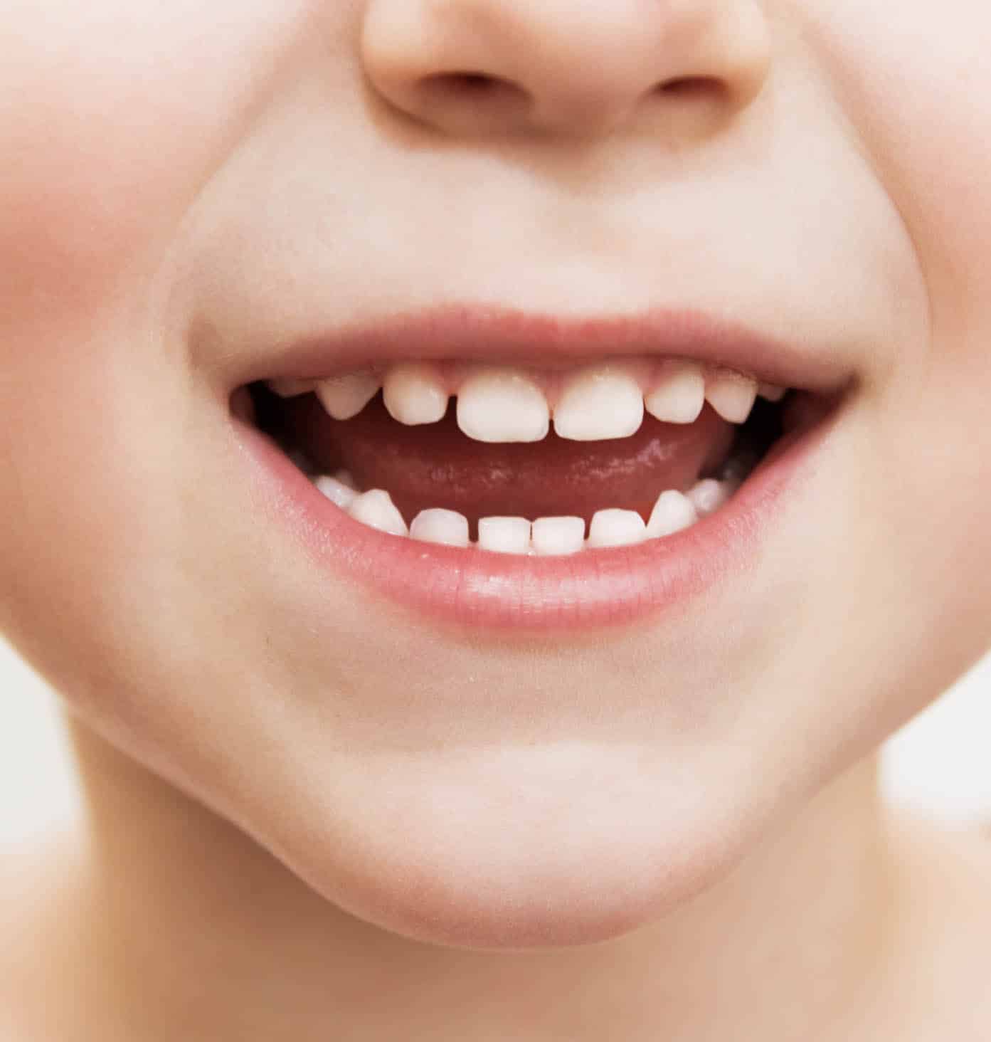 Child with primary teeth